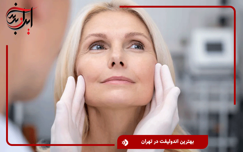 بهترین اندولیفت در تهران